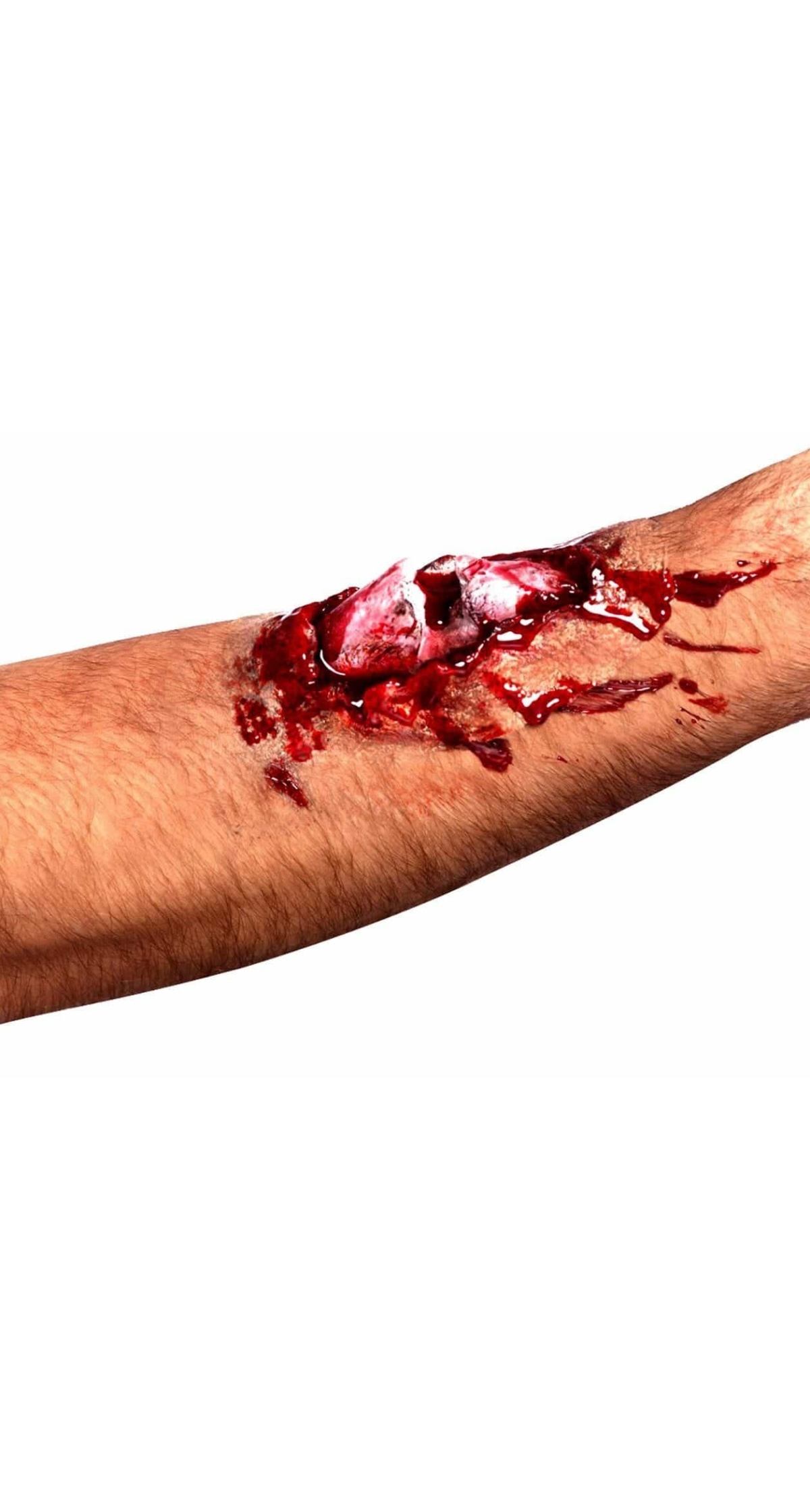 Latex Broken Bone Scar